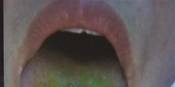 吃酥瓜舌头变绿,酥瓜美食背后的绿色奥秘